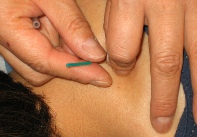 chinese medicine store roseville Village Acupuncture - Center for Optimum Health