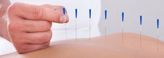 chinese medicine store roseville Oriental Acupuncture